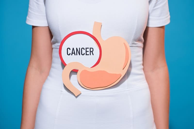Cáncer gástrico en Huancayo, Perú