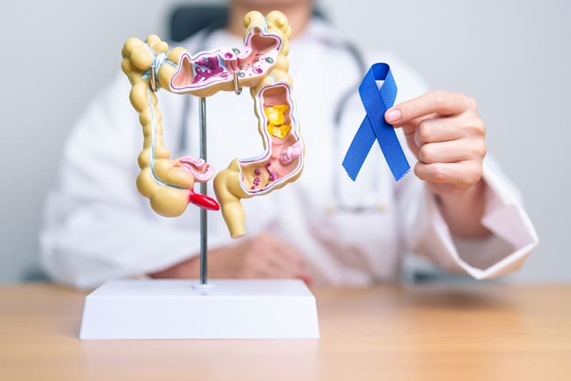 Programa prevención cáncer gástrico en Huancayo, Perú